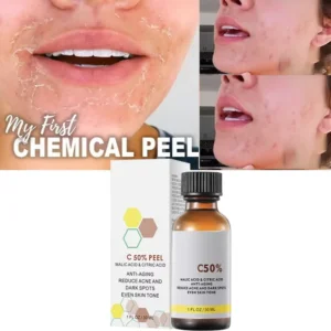 With Malic Acid And Citric Acid For Face Facial Peel 40% Peeling Serum Peeling Serum Chemical Peel Whitening Nourishing Essence